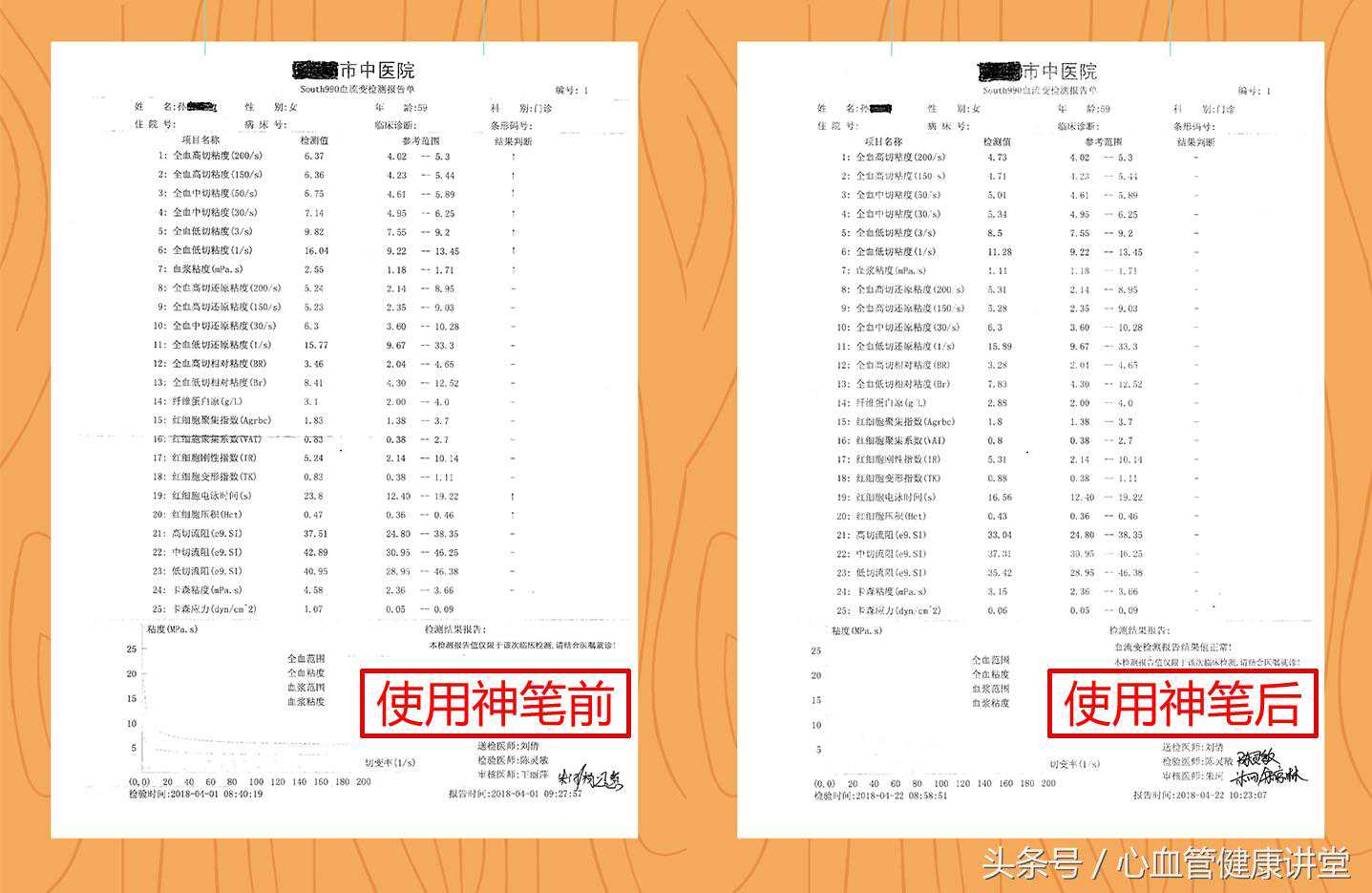 血流变检查对预报心脑血管病有何意义？