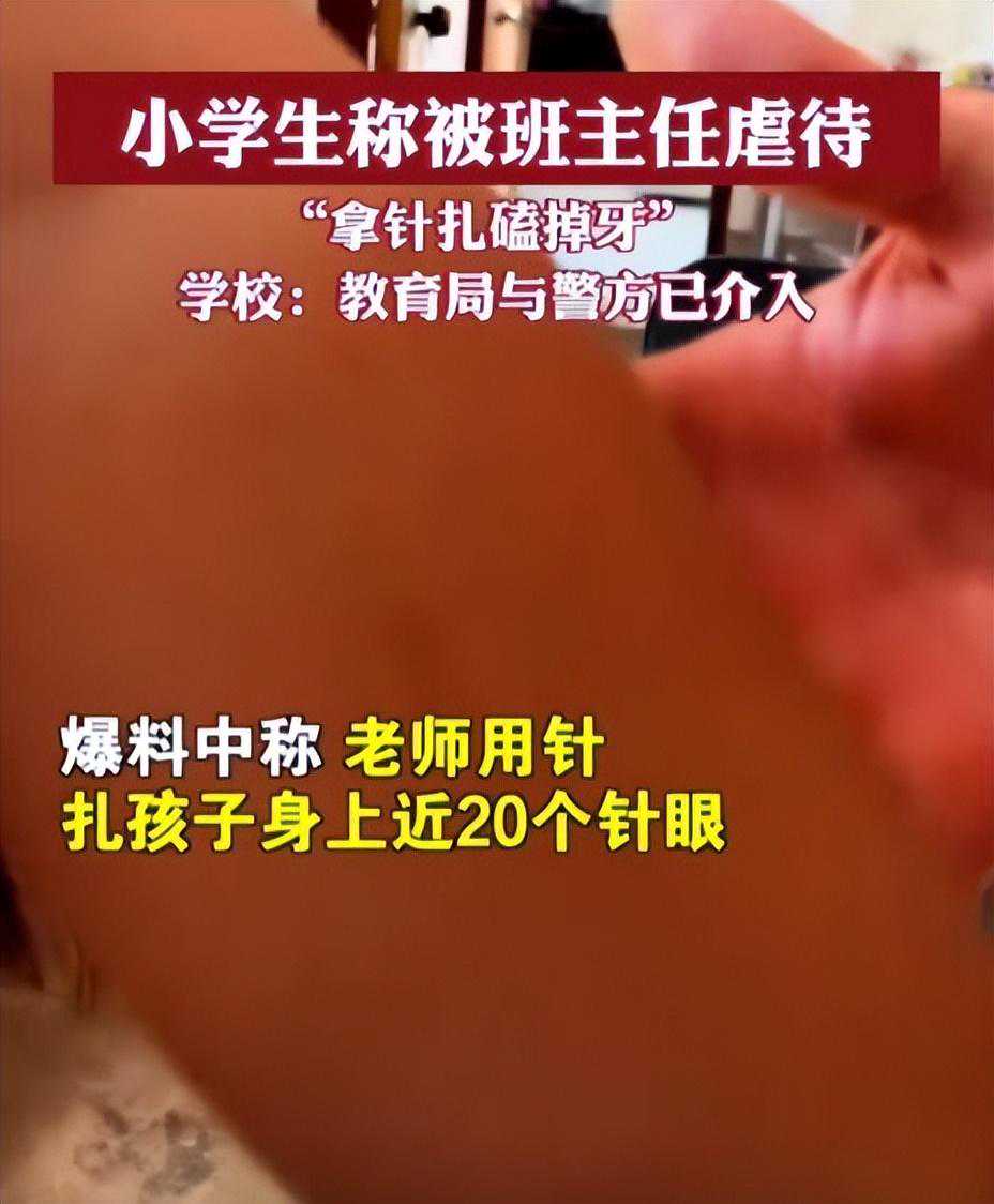 震惊！一名8岁男童竟被班主任连续虐待12天？