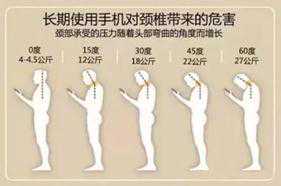 脖子疼就是颈椎病？不一定！颈椎健康自测法快来测一测